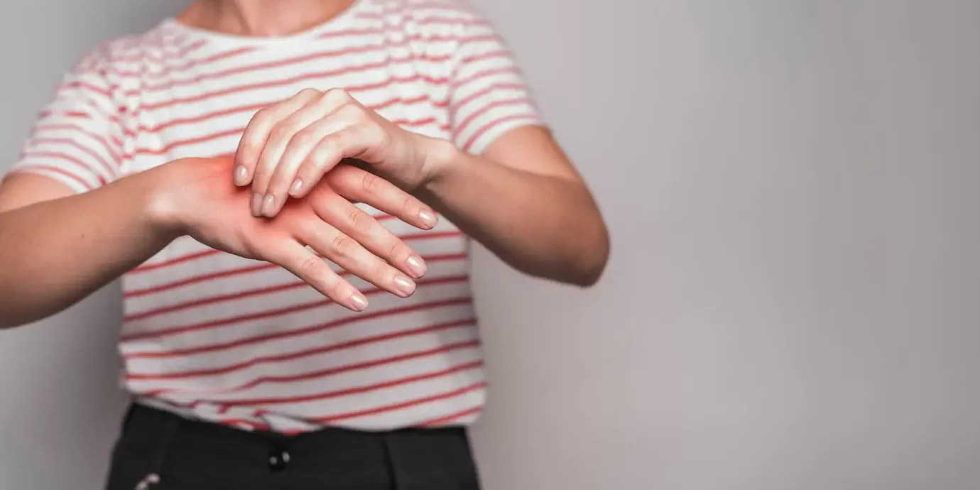Carpal Tunnel Syndrome Carpal Tunnel Syndrome