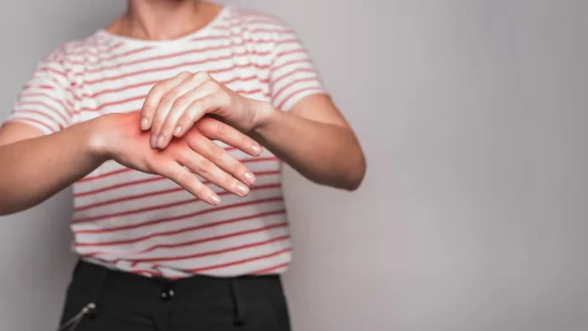 Carpal Tunnel Syndrome Carpal Tunnel Syndrome