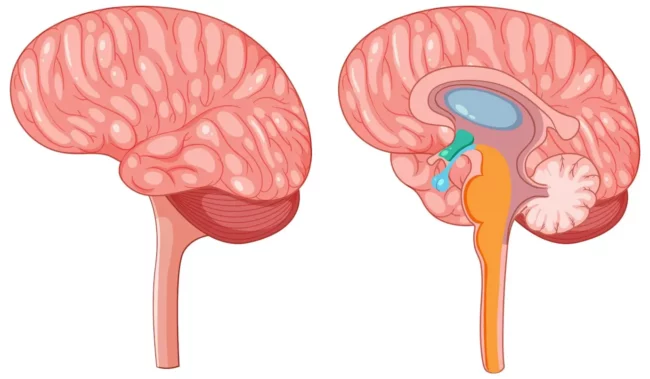 Cerebellopontine Angle Tumor Cerebellopontine Angle Tumor