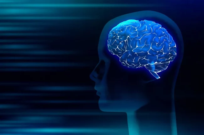 Hydrocephalus Hydrocephalus