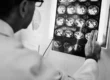 Intracranial Tuberculomas