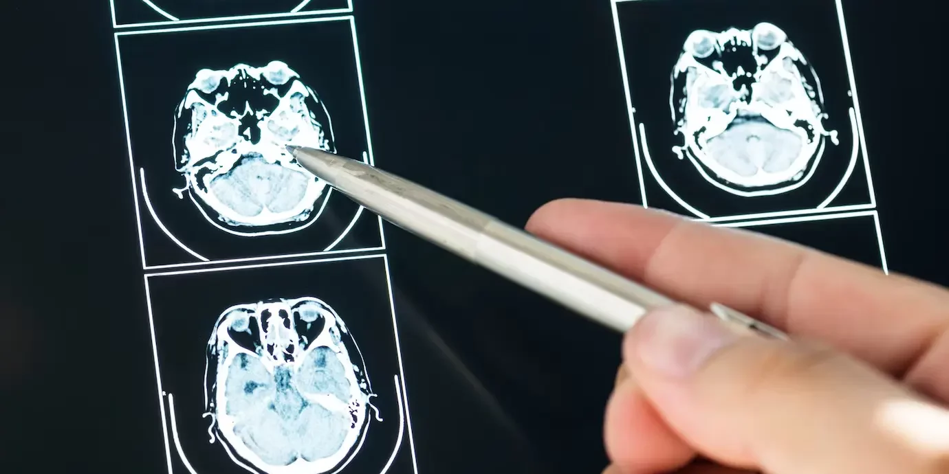 types of brain injuries types of brain injuries